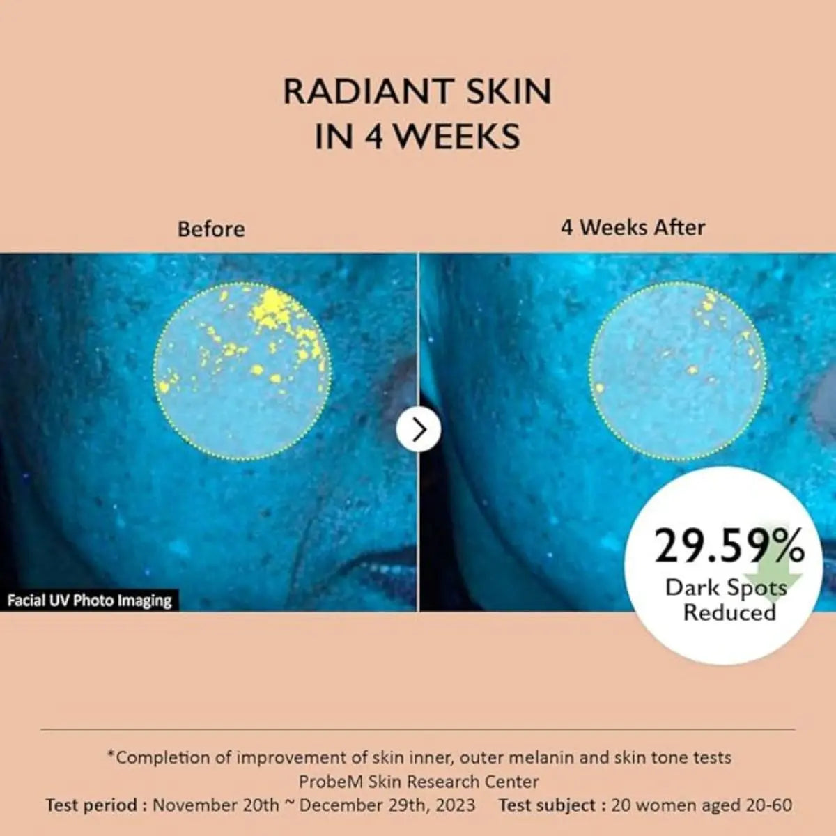 Centella 4% TXA Dark Spot Go Away - Haru Haru Wonder Haruharu wonder