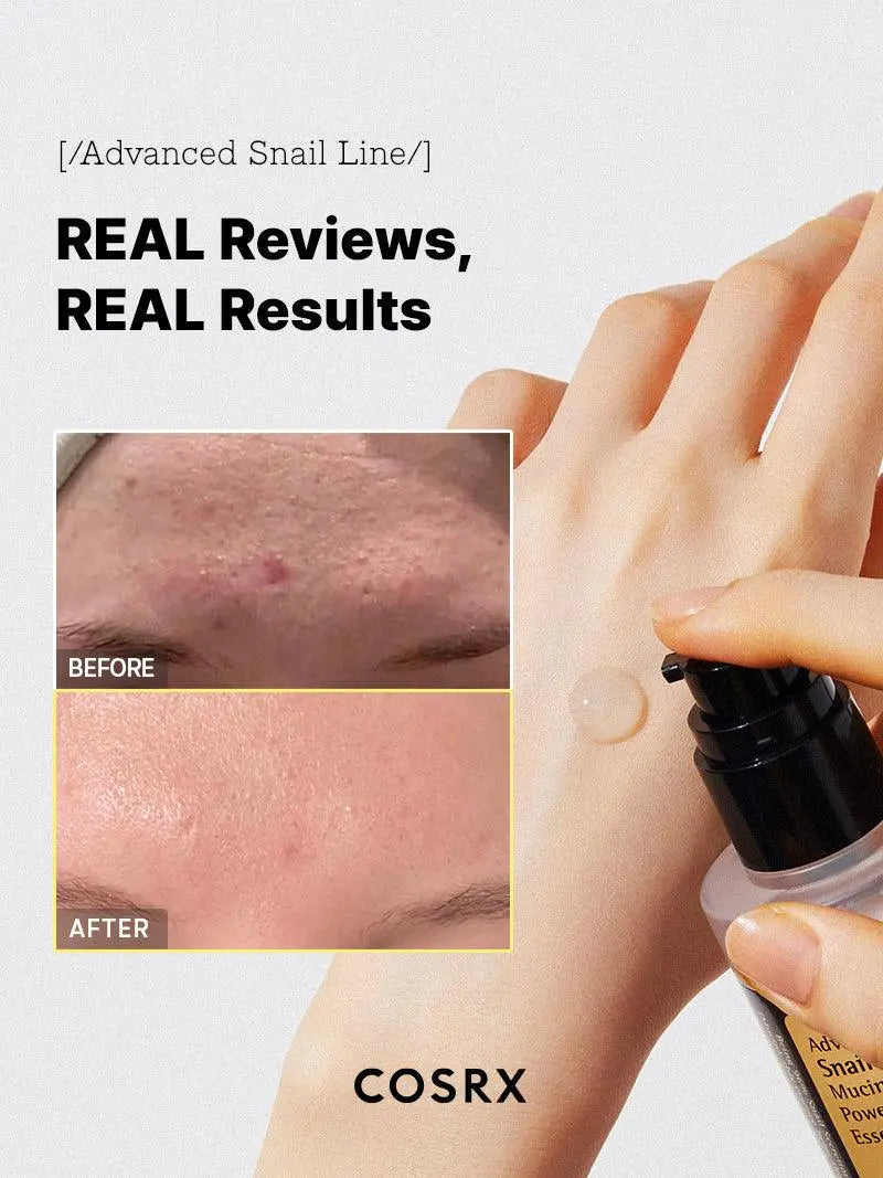 COSRX Essence Advanced Snail 96 Mucin Power Essence 